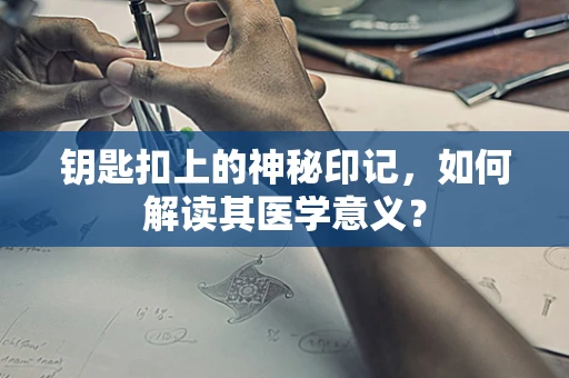 钥匙扣上的神秘印记，如何解读其医学意义？