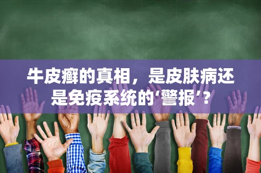 牛皮癣的真相，是皮肤病还是免疫系统的‘警报’？