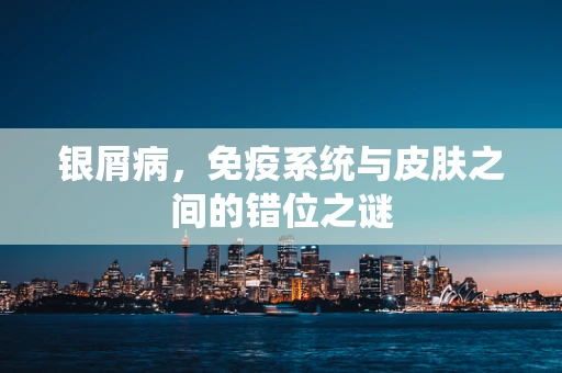 银屑病，免疫系统与皮肤之间的错位之谜