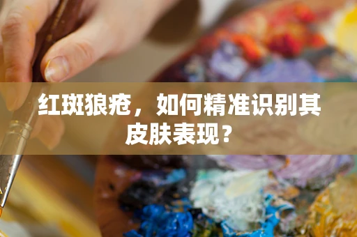 红斑狼疮，如何精准识别其皮肤表现？